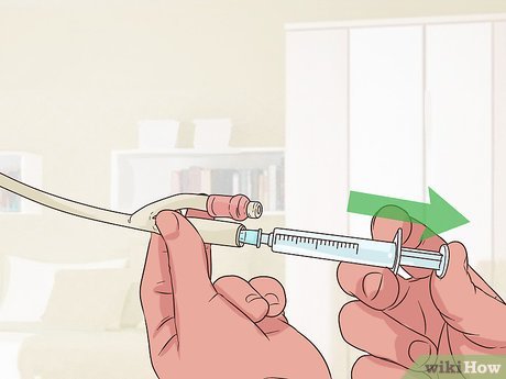 Effective Tips For Irrigating Foley Catheter: How To Irrigate Foley Catheter